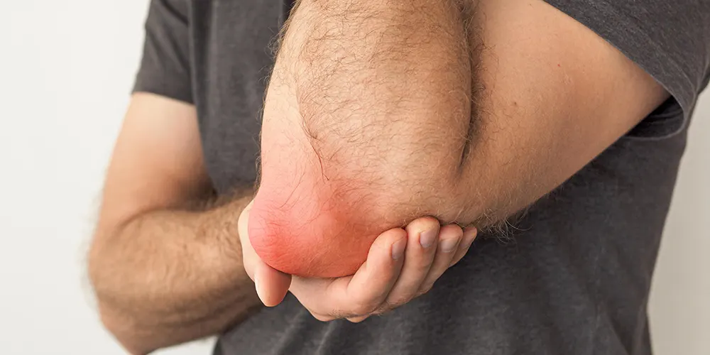 dry-needling-bursitis
