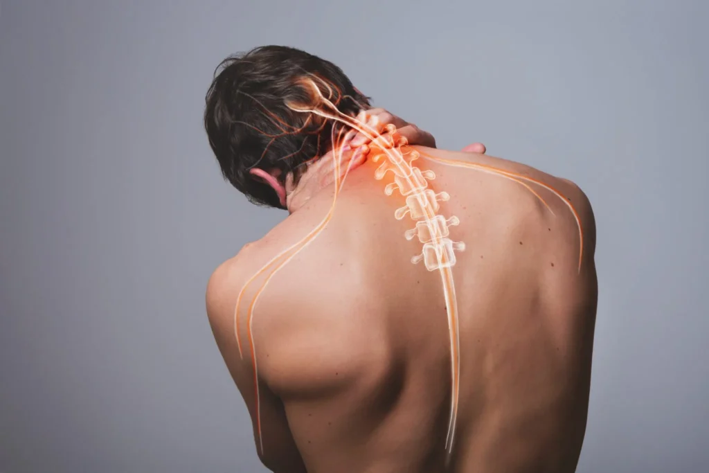 dry-needling-for-cervical-radiculopathy