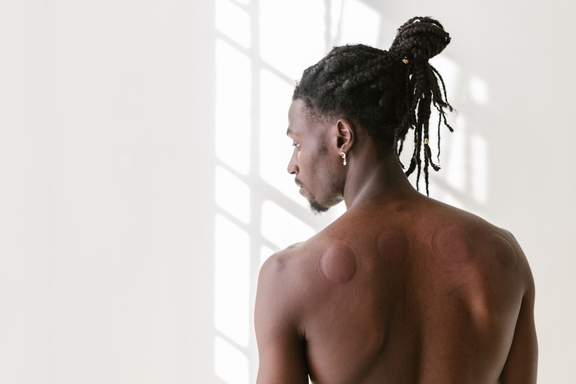 what-do-cupping-marks-mean