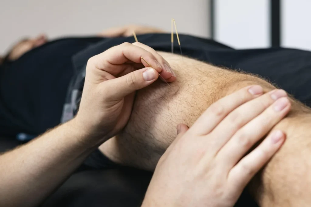 does-dry-needling-hurt